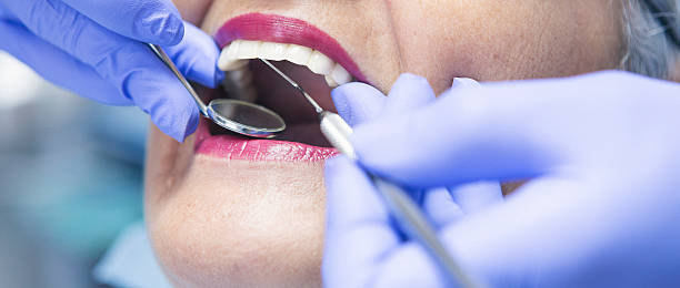 Best Emergency Dental Care for Abscessed Tooth in Daytona Beach Shores, FL